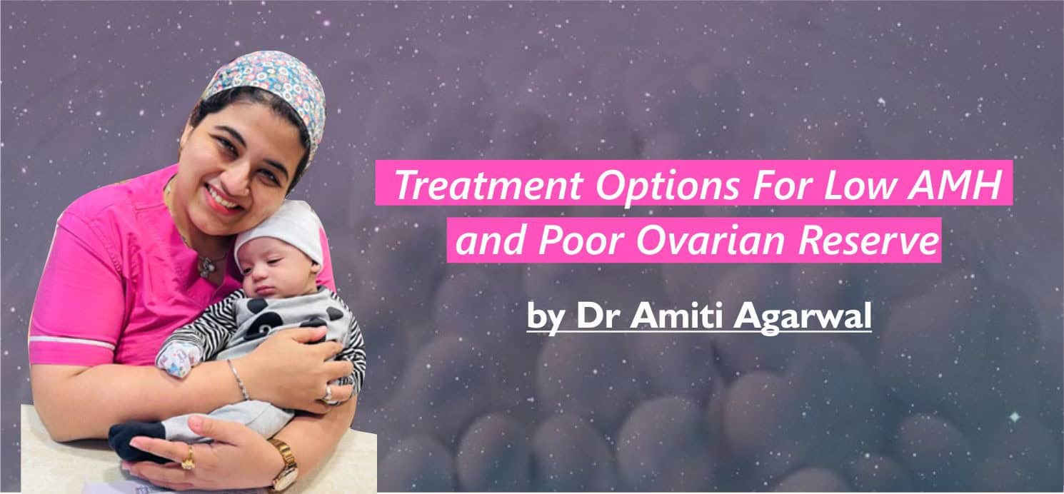 Treatment Options For Low AMH