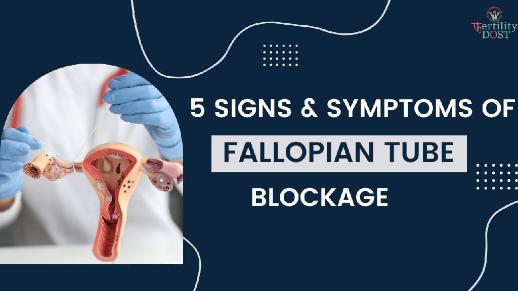 5 Signs and Symptoms of Fallopian Tube Blockage